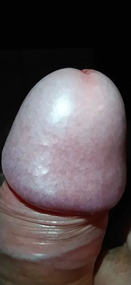 My Penis Is Swollen From The Blood Pulsing In It Nude Pics XHamster