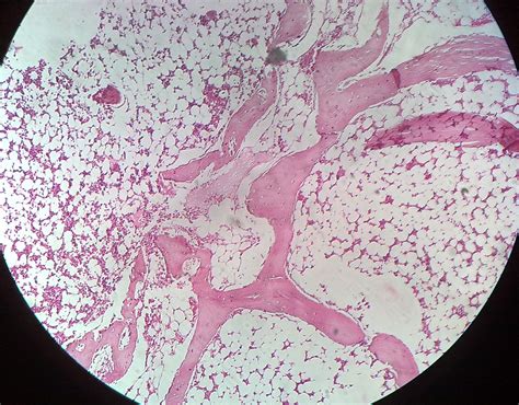 Howmed Images Medical Images For Easy Understanding