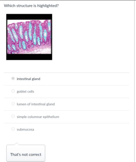 Solved Which Structure Is Highlighted Intestinal Glandgoblet Chegg