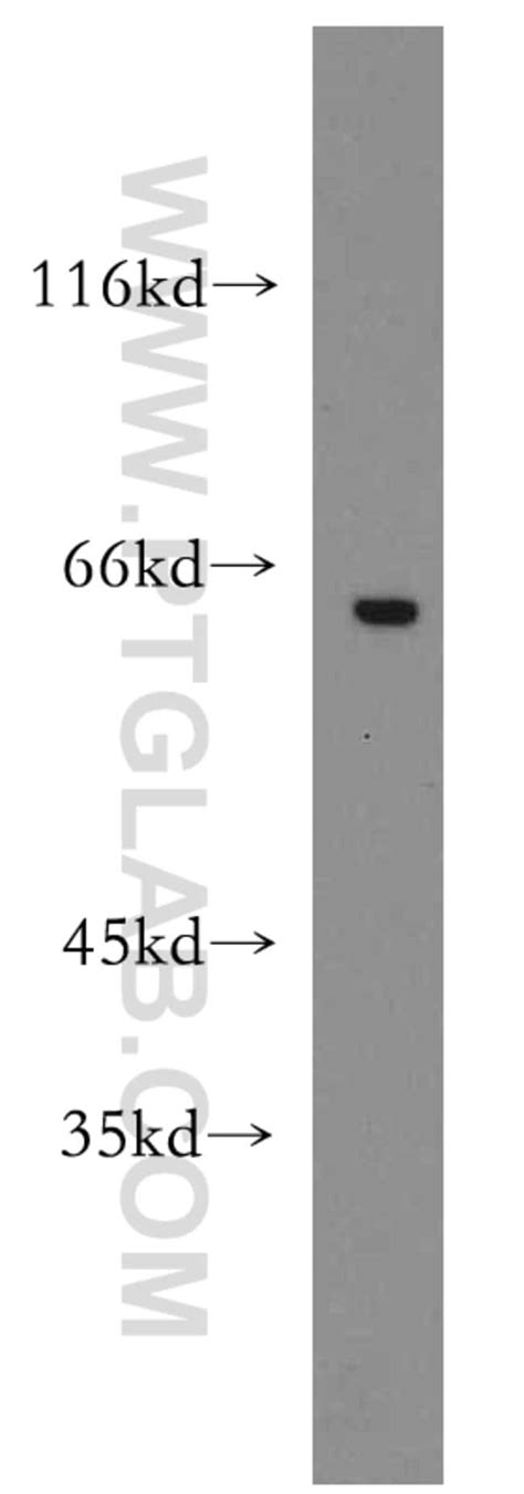 GPR162 Rabbit anti Human Polyclonal Proteintech 150 μL Unconjugated