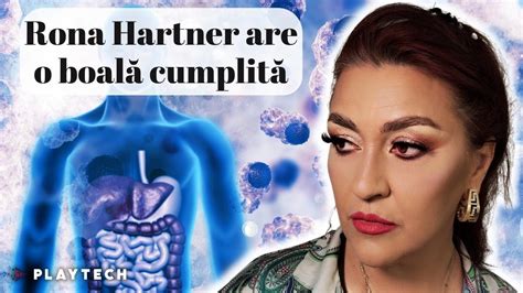 Rona Hartner Diagnosticat Cu O Boal Incurabil Artista Se Lupt