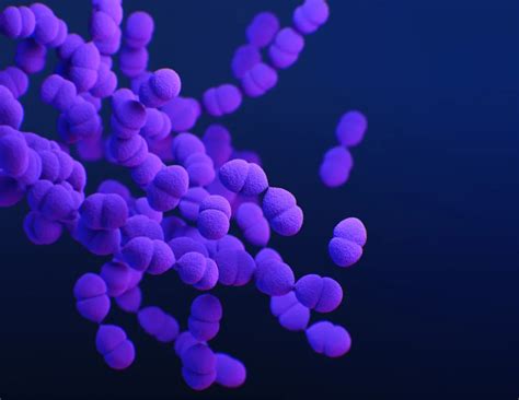 Diagnosing And Treating Rust-Colored Sputum