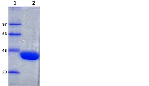 Cloning Purification Crystallization And Preliminary X Ray