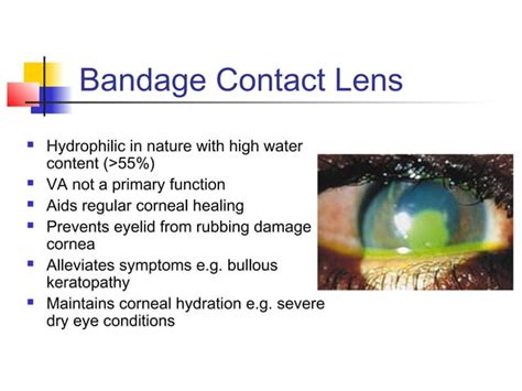 Role of bandage contact lens in corneal wound healing