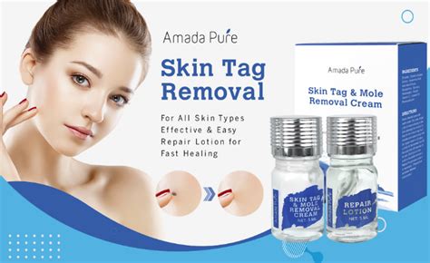 Amada Pure Mole Corrector Skin Tag Remover Will Make Your Skin