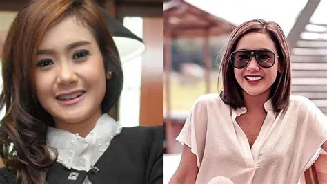 Transformasi 6 Seleb Setelah Perbaikan Gigi Terbaru Ely Sugigi Hot Liputan6