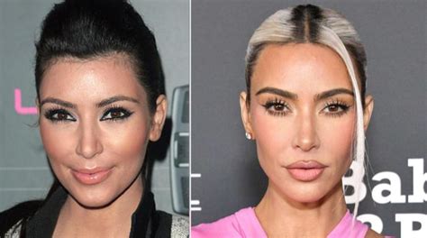 Kim Kardashian S Plastic Surgeries And Cosmetic Procedures Revealed