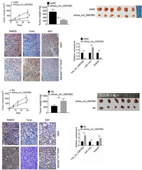 Down Regulation Of Hsa Circ Inhibited Tumor Growth In Vivo A