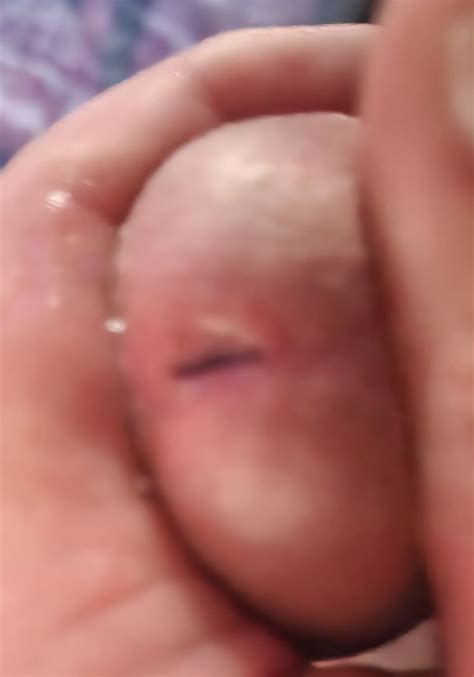 Big Thick Cock 11 Nude Pics XHamster