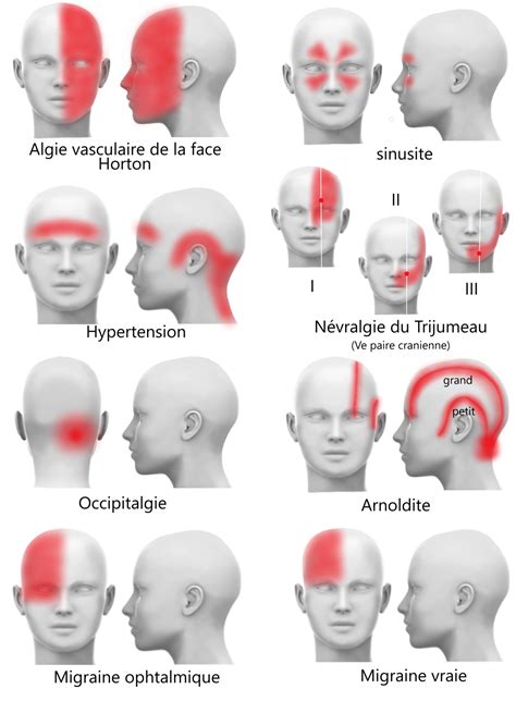 Les Maux De T Te H L Na Zeph