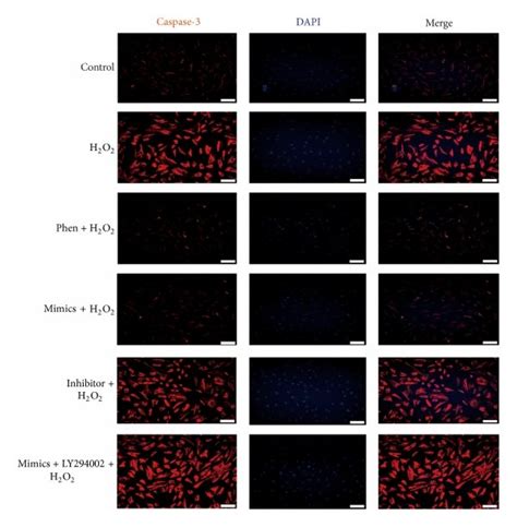 Ptenpi3kakt Pathways Contribution To H2o2 Induced Apoptosis In