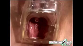 Speculum Xvideos
