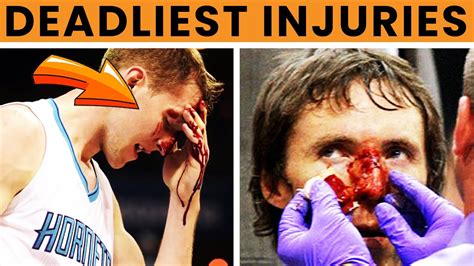 Worst Basketball Injuries