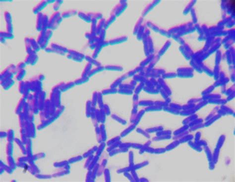 Gram Positive Bacteria Characteristics