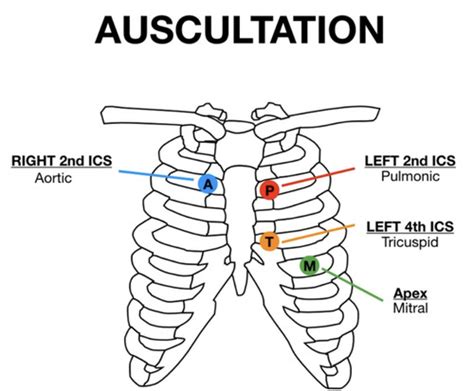 PDX Heart Sounds And Murmurs Flashcards Quizlet