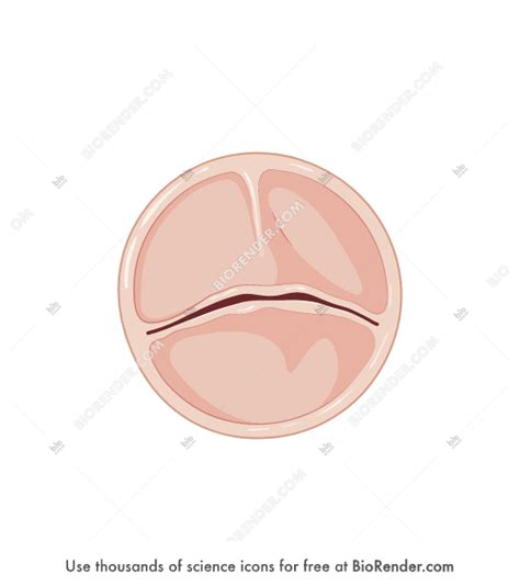 Free Aortic valve (bicuspid) Icons, Symbols & Images | BioRender