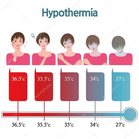 Hypothermia ⬇ Vector Image By © Seesawname Vector Stock 78701786