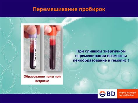 Правила взятия крови - презентация онлайн