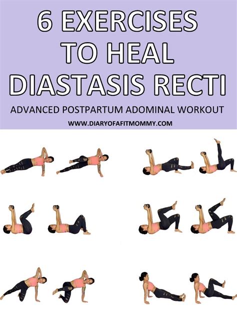 6 Exercises To Fix Heal Diastasis Recti Advanced Postpartum Abdominal