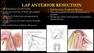 Lap Anterior Resection Step By Step Operative Surgery Pptx