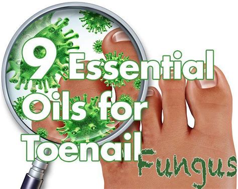 Essential Oils For Toenail Fungus Include Tea Tree Thyme Manuka Oregano Clove Cinnamon An