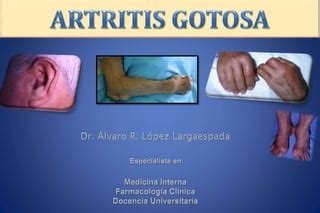 Artritis Gotosa Pptx Caracter Sticas Definici N Epidemiolog A Y