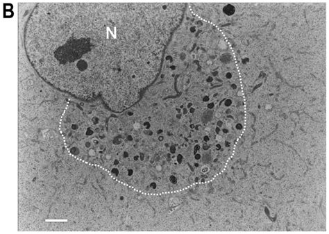 Targeting The Integrated Networks Of Aggresome Formation Proteasome