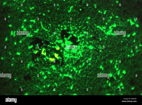 This Fluorescent Acid Fast Stained Smithwick Photomicrograph Stock