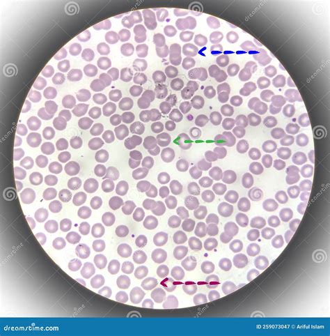Complete Blood Count CBC Test Procedure. Laboratory Test Tubes With