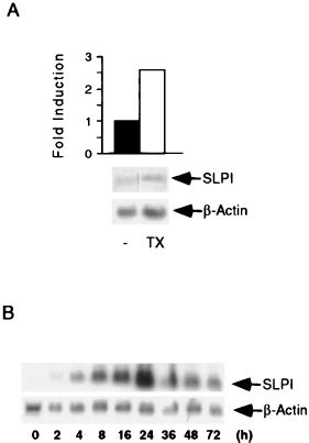 Induction Of Slpi By Taxol A Primary Macrophages Macrophages