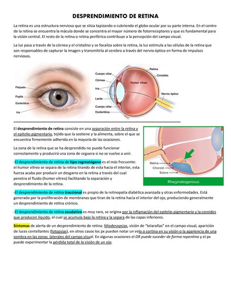 Desprendimiento DE Retina DESPRENDIMIENTO DE RETINA La Retina Es Una