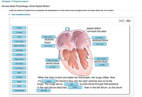 Solved Nurses Need Physiology Atrial Septal Defect Baby A Chegg