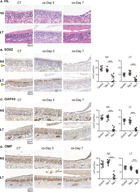 Evidence For The Spread Of Sars Cov And Olfactory Cell Lineage