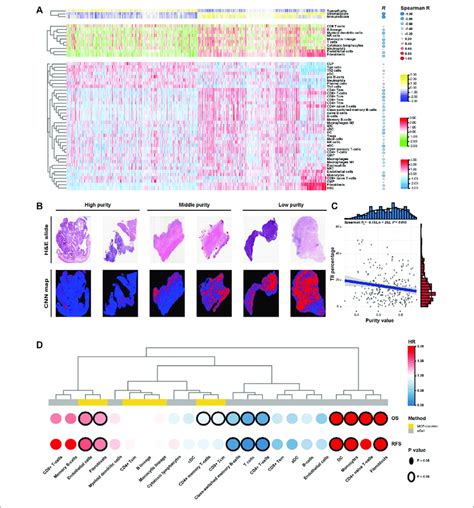 Tumour Microenvironment Features Of Tumour Purity In Gastric Cancer