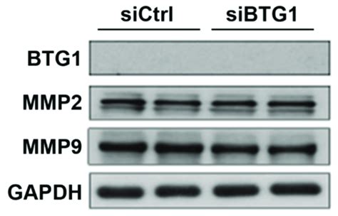 Effect Of Btg Downregulation On The Protein Expression Levels Of Btg