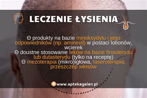 Łysienie androgenowe plackowate telogenowe przyczyny objawy