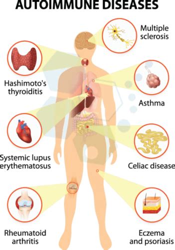 Opt Autoimmunity Flashcards Quizlet