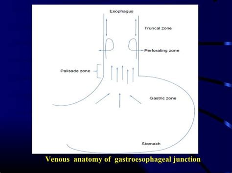 Portal Hypertension Classification And Pathophysiology