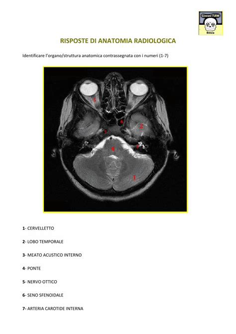 Pdf Anatomia Radiologica Risposte Microsoft Word