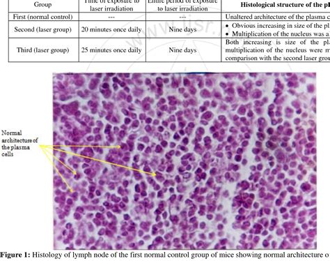 Plasma Cells Histology