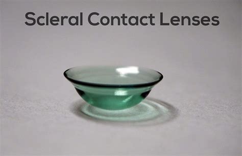 Frequently Asked Questions About Scleral Contact Lenses