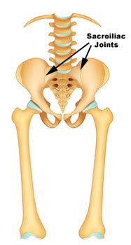 Sacroiliitis: Symptoms, Causes, Diagnosis, Treatment | MD-Health.com