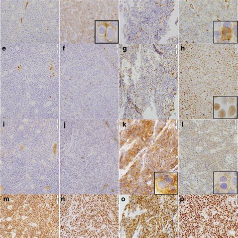 Representative Immunostaining For S1PR1 Ad PSTAT3 Eh S1PR2