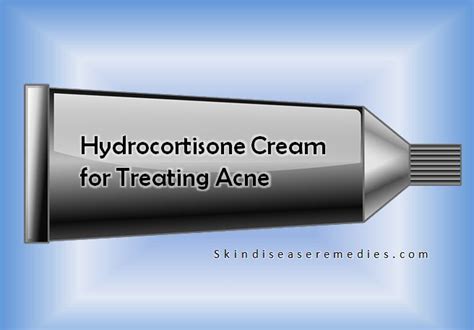 Cortisone Cream for Treating Acne - Skin Disease Remedies