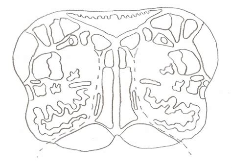 Brainstem Image Labeling Rostral Medulla Diagram Quizlet