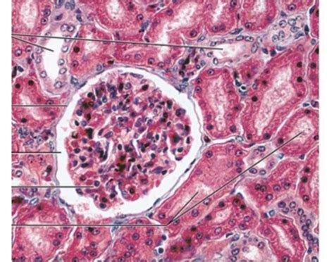 renal histology- cortex Quiz