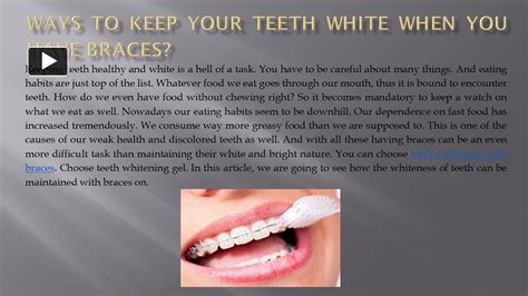 Ppt Ways To Keep Your Teeth White When You Have Braces Powerpoint