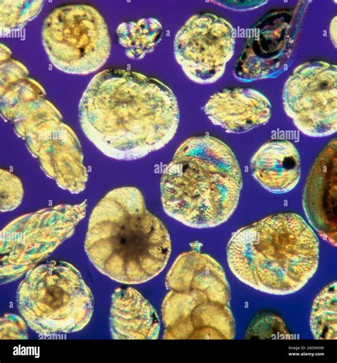 Foraminiferan Conchas Micrograf A De Luz De Variadas Especies De