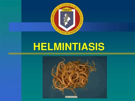 Ppt Helmintiasis Powerpoint Presentation Free Download Id6396165