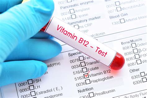 Vitamin B12: Why it’s Important and How to Avoid B12 Deficiency